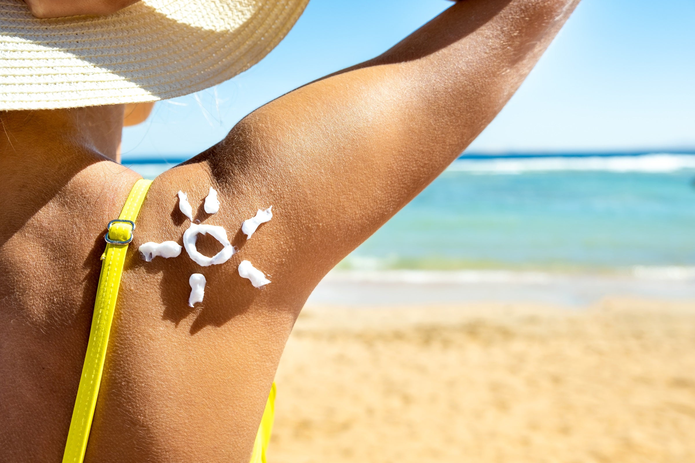 The Benefits of CBD Lotion for Sunburn Relief